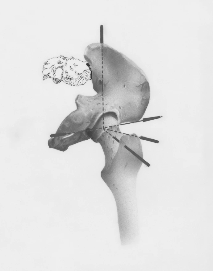 a black and white photo of a human skull